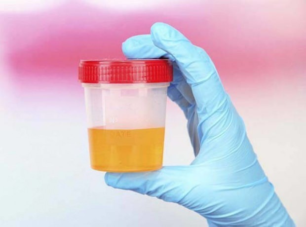 Test di gravidanza con urina