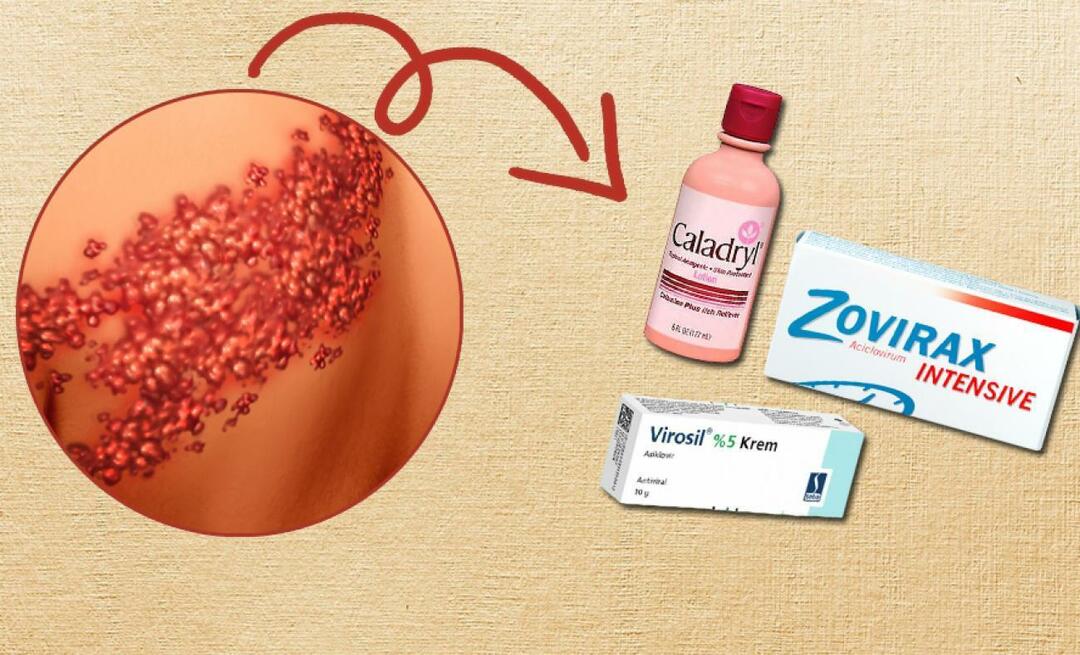 L'herpes zoster più efficace nelle creme da farmacia 2023! Creme per scottature notturne