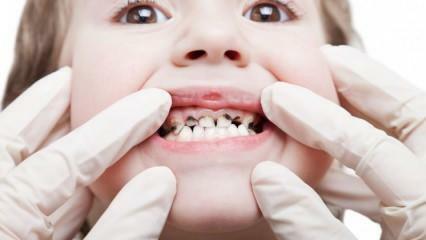 Fai le cure dentistiche di tuo figlio durante il semestre!
