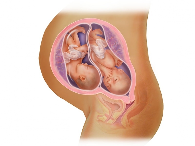 Gravidanza gemellare in fecondazione in vitro! Cos'è il trasferimento di embrioni?