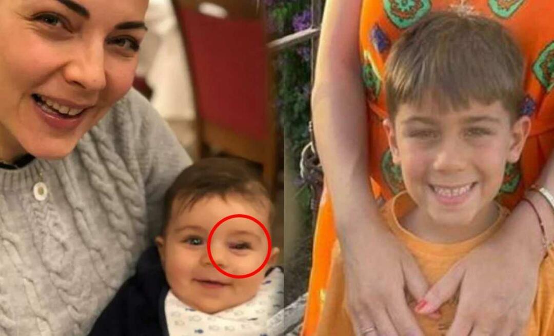 Burcu Kara ha annunciato la malattia di suo figlio! Il gonfiore negli occhi è un segno di un tumore...