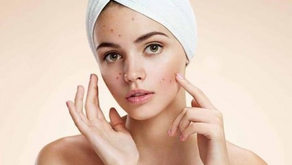 Le pillole per l'acne sono dannose?