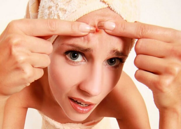 L'acne causa mal di testa? Cosa fare contro l'acne dolorosa? Dolore da acne ...