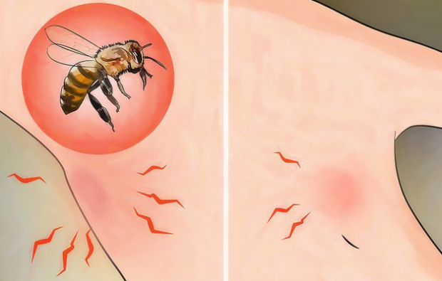 Cos'è l'allergia alle api e quali sono i sintomi? Metodi naturali che fanno bene alle punture di api