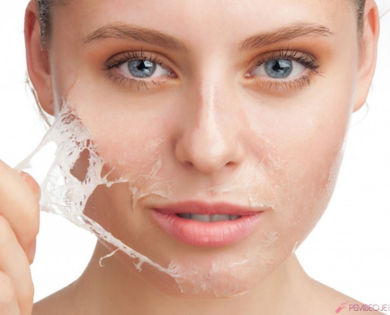 Che cosa è buono per il peeling della pelle e come è il peeling della pelle? Rimedio domestico per il peeling della pelle