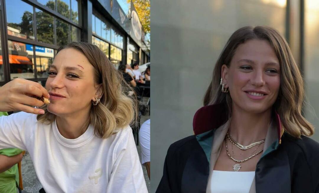 Cosa è successo al sopracciglio di Serenay Sarıkaya, di cui è certa la nuova serie digitale? Dichiarazione del famoso attore