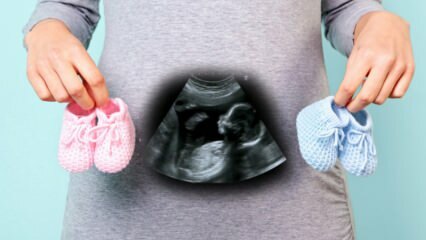 Il sesso del bambino sarà determinato nel primo trimestre di gravidanza?