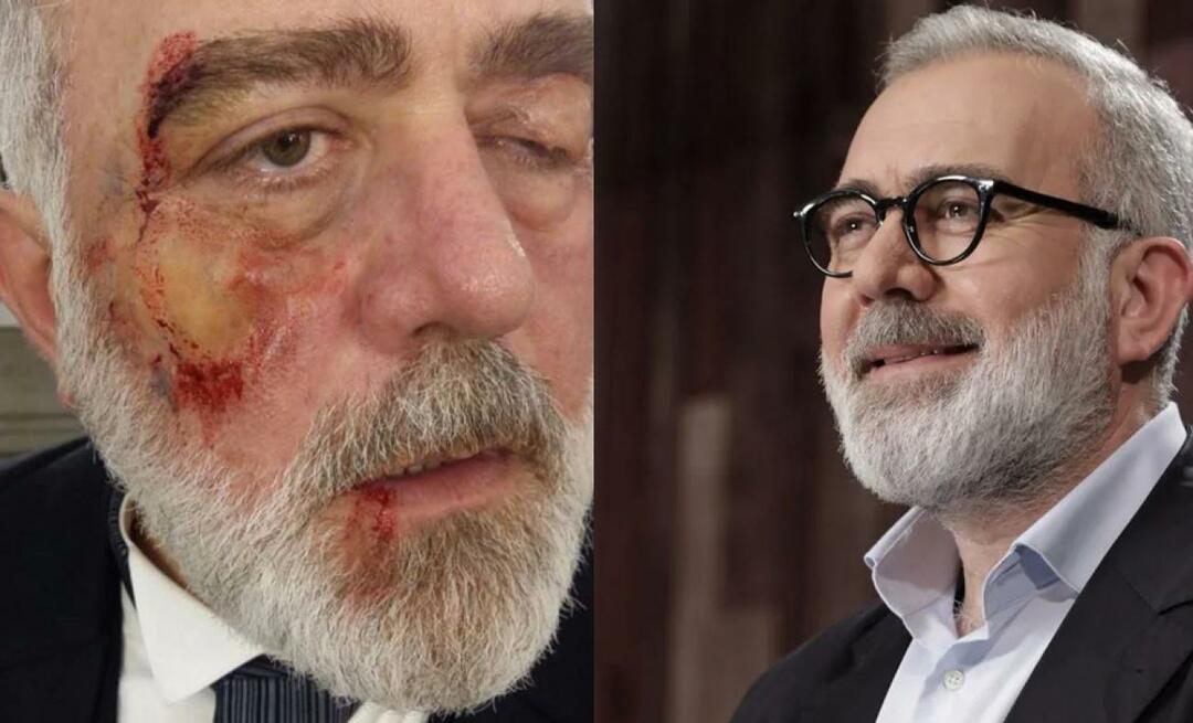 Bahadır Yenişehirlioğlu ha portato i cuori alla bocca! Con i suoi occhi lividi e la bocca sanguinante...