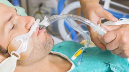 Qual è l'intubazione che ha detto Fahrettin Koca? Cosa significa intubare il paziente? Il paziente intubato guarirà?