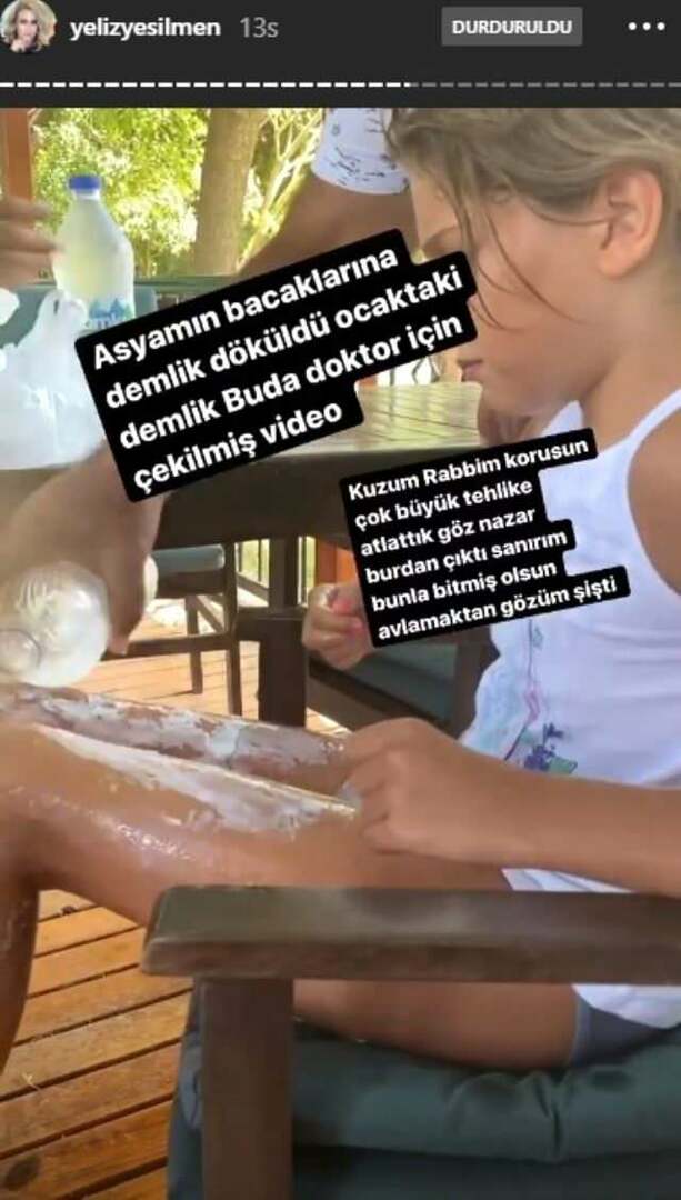 Acqua bollente è stata versata sulle gambe della figlia di Yeliz Yeşilmen