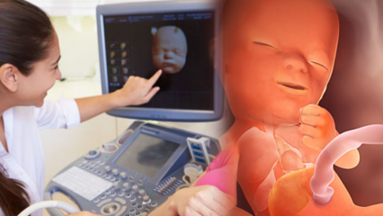 Quale organo si sviluppa per primo nei bambini? Sviluppo del bambino settimana per settimana