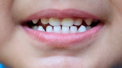 Come insegnare ai bambini la cura dei denti?