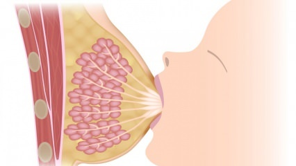 Cos'è la mastite (infiammazione del seno)? Sintomi di mastite e trattamento durante l'allattamento