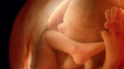 Non mostrare il sesso del bambino agli ultrasuoni! Come guardano i neonati e le ragazze agli ultrasuoni?