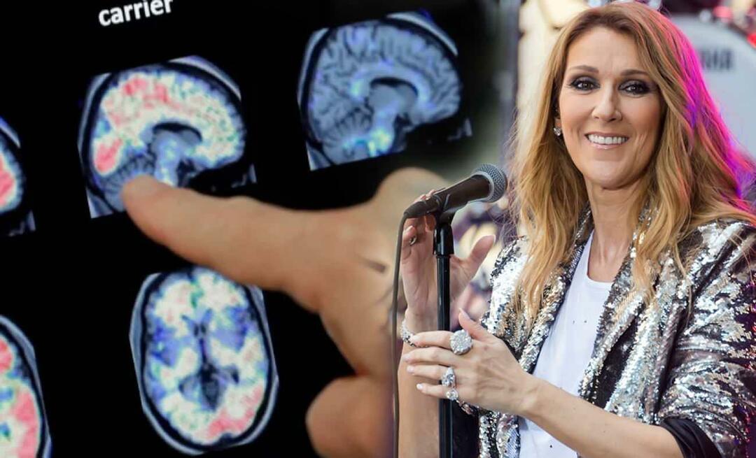 Cos'è la sindrome della persona rigida? Qual è la malattia di Celine Dion?