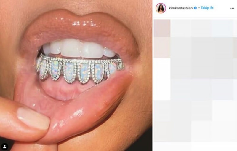 La gemma dentale da $ 5.000 di Kim Kardashian
