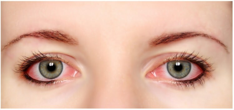 Il mascara e l'eyeliner sono allergici agli occhi?
