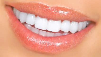 Metodi di sbiancamento dei denti naturali
