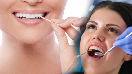 Come mantenere la salute orale e dentale? Cosa dovrebbe essere considerato quando si puliscono i denti?