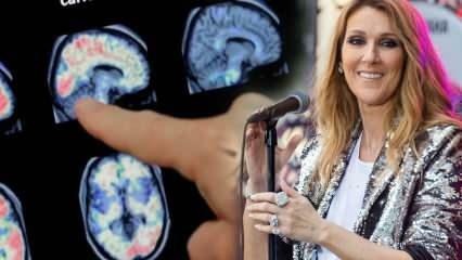 Cos'è la sindrome della persona rigida? Celine Dion