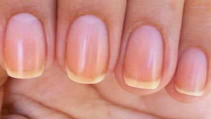 Perché le unghie diventano gialle? Il metodo più semplice per sbiancare le unghie ingiallite dallo smalto