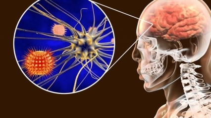 Cos'è la meningite e quali sono i sintomi? Esiste un trattamento per la meningite?
