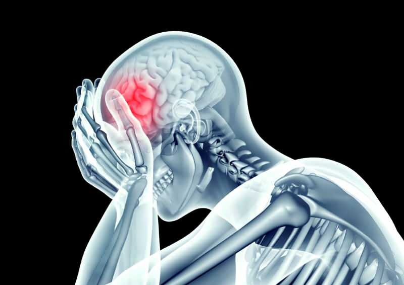 il croonavirus danneggia il cervello restringendo i vasi