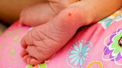 Perché viene prelevato sangue di tallone nei neonati? Requisiti per l'analisi del sangue al tallone nei neonati