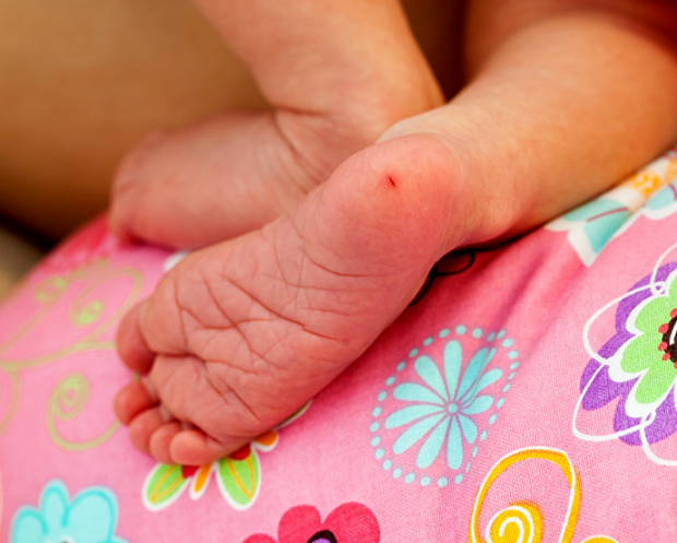 analisi del sangue al tallone nei neonati