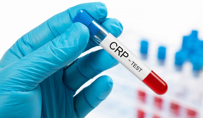 Perché la CRP nel sangue sale? Cos'è il CRP? Come abbassare il CRP?