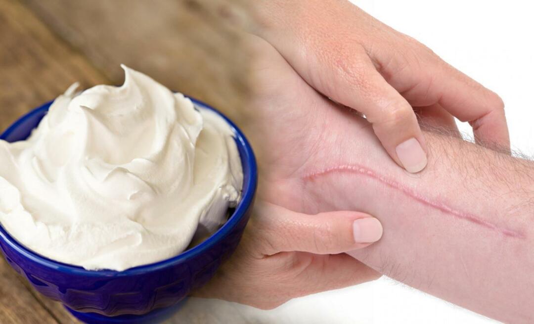 La crema per cicatrici più efficace! Quali sono le creme in farmacia che rimuovono le cicatrici 2023