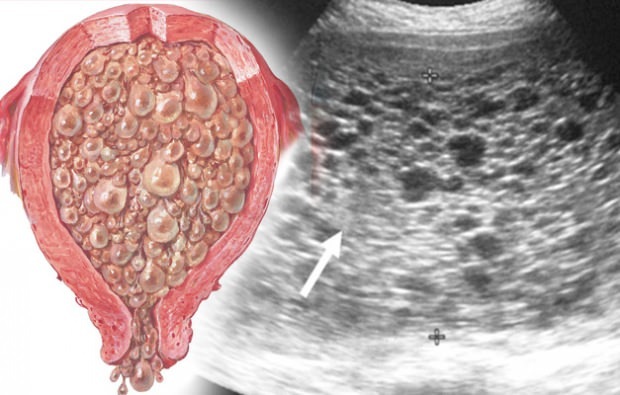 Quali sono i sintomi della gravidanza dell'uva della gravidanza dell'uva