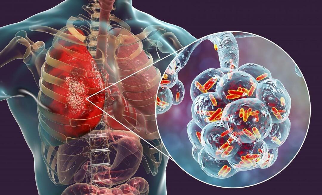Cos’è la polmonite e quali sono i suoi sintomi? Come viene trattata la nuova epidemia da virus della polmonite?