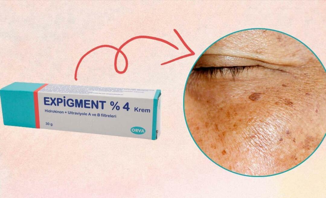 Cosa fa la crema Expigment? Come usare la crema Expigment? Scadenza crema prezzo 2023