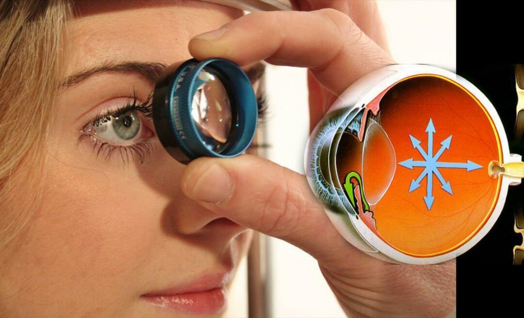 Cos'è il glaucoma? Fate attenzione a questa malattia che progredisce insidiosamente senza dare alcun sintomo!