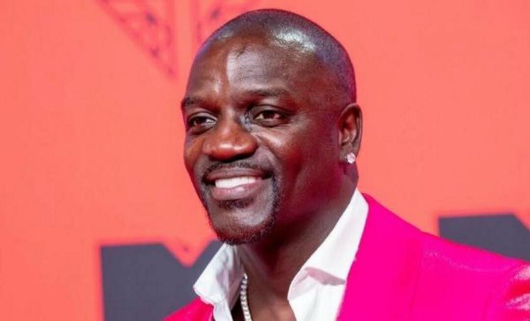 Anche il cantante americano Akon ha preferito la Turchia per il trapianto di capelli! Ecco il prezzo che ha pagato...