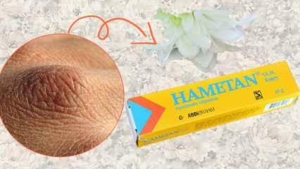 Cosa fa la crema Hametan? Crema Hametan uso domestico! Differenze di Hametan