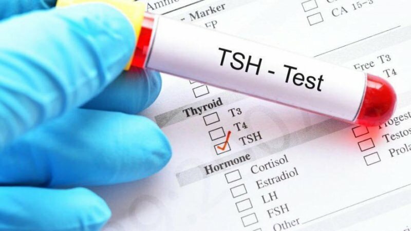tsh test è un test ormonale