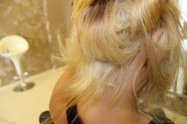 Cosa si fa ai capelli che bruciano dal centro? Come devono essere mantenuti i capelli trattati?