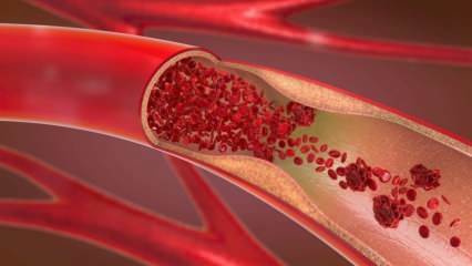 Che cos'è l'anemia (anemia)? La debolezza costante indica l'anemia! Alimenti che fanno bene all'anemia ...