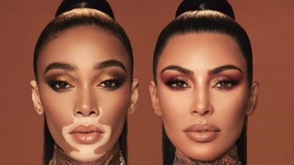 Kim Kardashian e Winnie Harlow sono diventati volti pubblicitari nella stessa cornice!