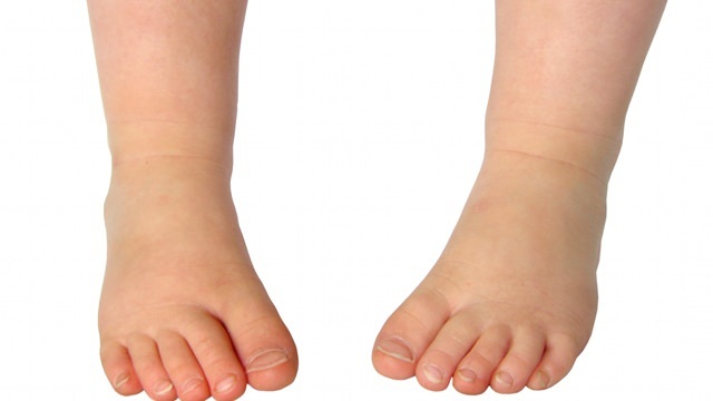 I 3 problemi più comuni nella salute dei piedi