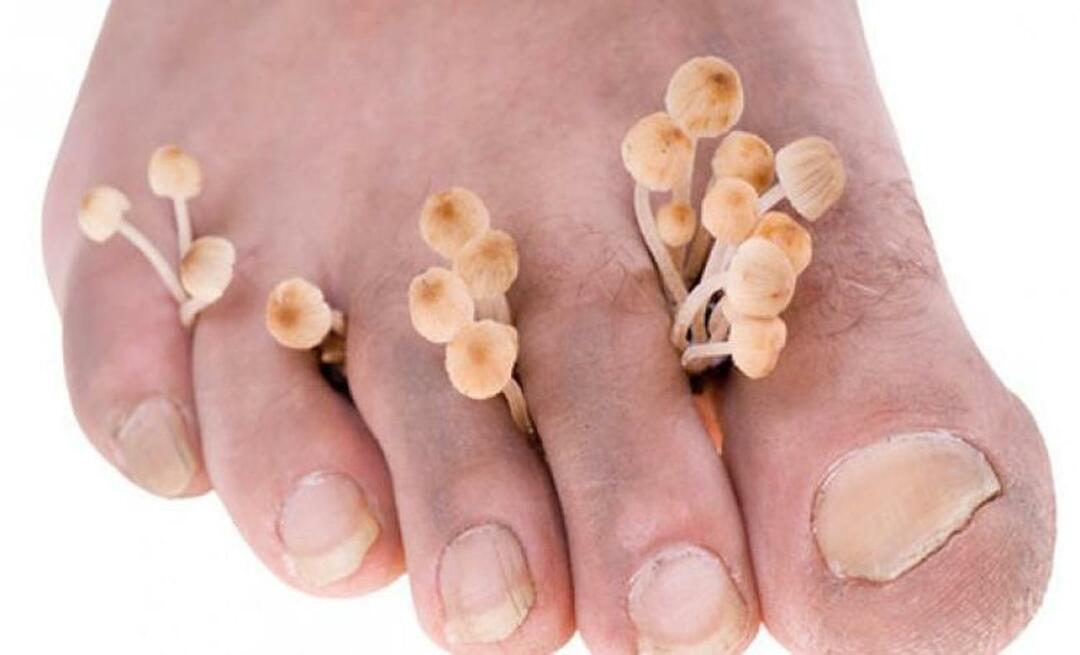 Come si trasmette il fungo del piede?