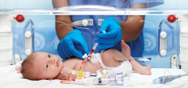 Malattia di ROP nei neonati