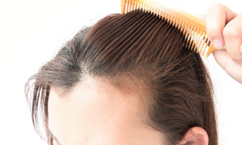 soluzioni per la perdita dei capelli dopo il parto! Cosa fa bene alla caduta dei capelli?