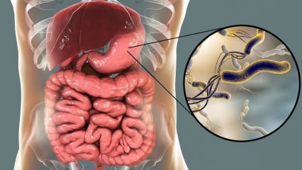 Che cos'è Helicobacter Pylori (microbo dello stomaco)? Malattie causate da Helicobacter Pylori ...