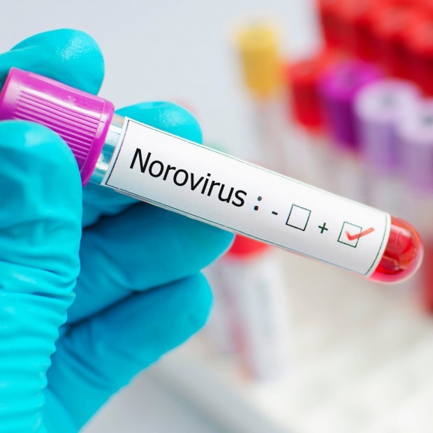 Che cos'è il norovirus e quali sono le malattie