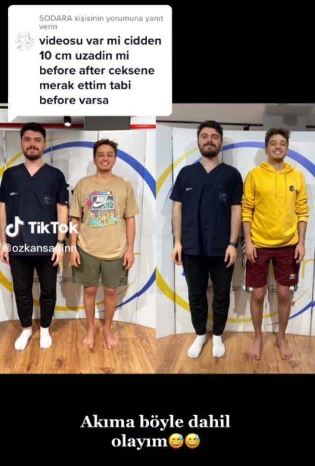 Özkan Sağın ha fatto prima e dopo l'operazione