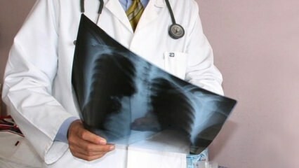 Gli esperti hanno annunciato! Aumento delle morti per cancro al polmone