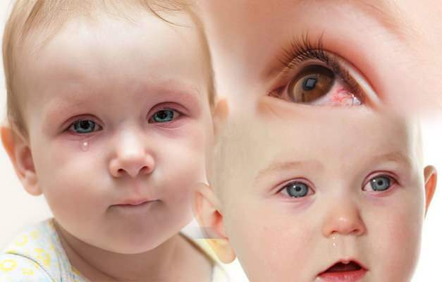 Perché gli occhi dei bambini ottengono sangue? Come passa l'emorragia oculare in un neonato?